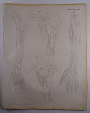 Load image into Gallery viewer, Oesterreicher, Heinrich: Anatomischer Atlas - Gefälslehre Taf: LXVI
