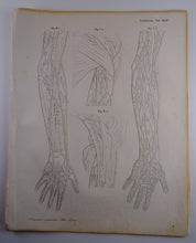Load image into Gallery viewer, Oesterreicher, Heinrich: Anatomischer Atlas - Gefälslehre Taf: XLIV
